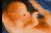   1~10个月的胎动图，看看怀胎十月，宝宝是如何成长的？