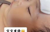 宝宝发烧发热护理大全-妈妈们一定要知道的护理常识